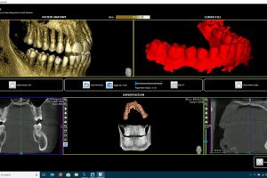 stl overlay in ais