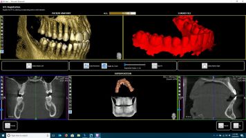 stl overlay in ais