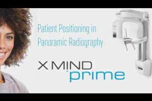 x mind prime patient positioning