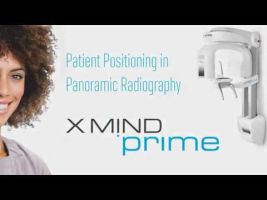 x mind prime patient positioning