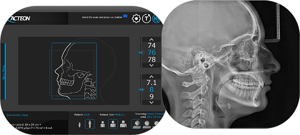 voxel dental x mind prime with ceph pano