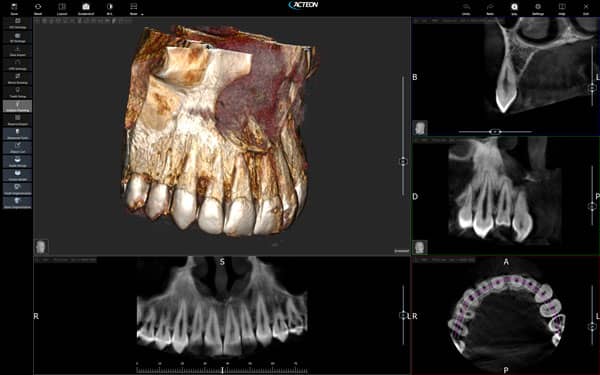 voxel dental x mind trium quality