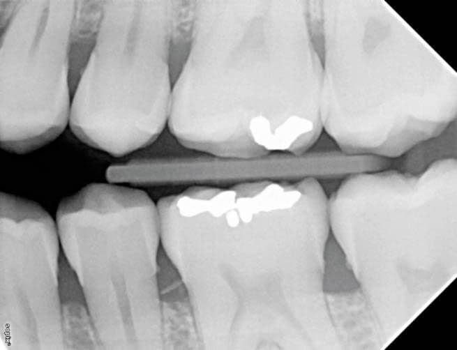 voxel dental xmind unity contrast